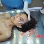 Examination of dead female