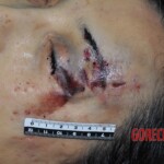 Examination of dead female