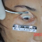 Examination of dead female