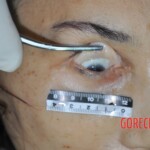 Examination of dead female