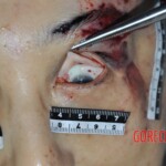 Examination of dead female