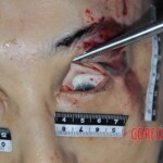 Examination of dead female