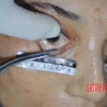 Examination of dead female