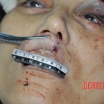 Examination of dead female