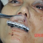 Examination of dead female