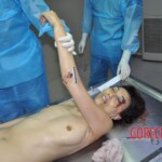 Examination of dead female