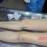 Examination of dead female