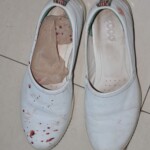 Examination of dead female