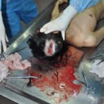 Examination of dead female