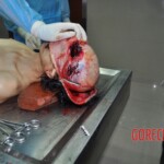 Examination of dead female