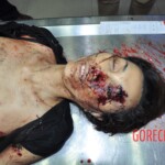 Examination of dead female