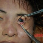 Carbon monoxide death