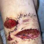 Cinnamonnoir self-harm