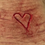 Cinnamonnoir self-harm