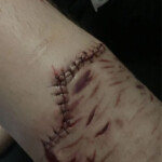 Cinnamonnoir self-harm