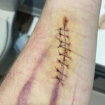 Cinnamonnoir self-harm