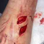 Cinnamonnoir self-harm