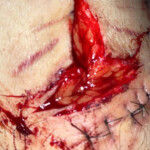 Cinnamonnoir self-harm