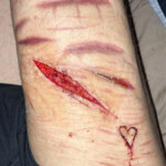 Cinnamonnoir self-harm