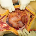 Autopsy of Chinese woman