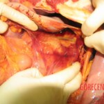 Autopsy of Chinese woman