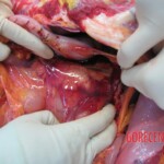 Autopsy of Chinese woman