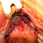 Autopsy of Chinese woman