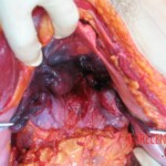 Autopsy of Chinese woman