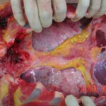 Autopsy of Chinese woman