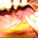 Autopsy of Chinese woman