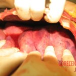 Autopsy of Chinese woman