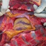 Autopsy of Chinese woman