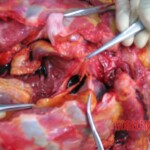 Autopsy of Chinese woman