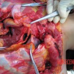 Autopsy of Chinese woman