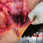 Autopsy of Chinese woman