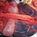 Autopsy of Chinese woman