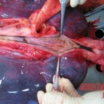 Autopsy of Chinese woman