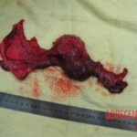 Autopsy of Chinese woman