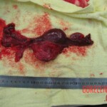 Autopsy of Chinese woman