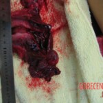 Autopsy of Chinese woman