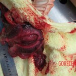 Autopsy of Chinese woman