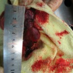 Autopsy of Chinese woman