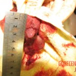 Autopsy of Chinese woman