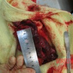 Autopsy of Chinese woman