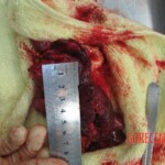 Autopsy of Chinese woman