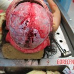 Autopsy of Chinese woman