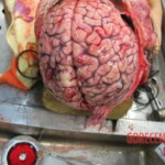 Autopsy of Chinese woman