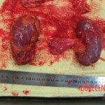 Autopsy of Chinese woman