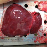 Autopsy of Chinese woman