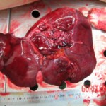 Autopsy of Chinese woman